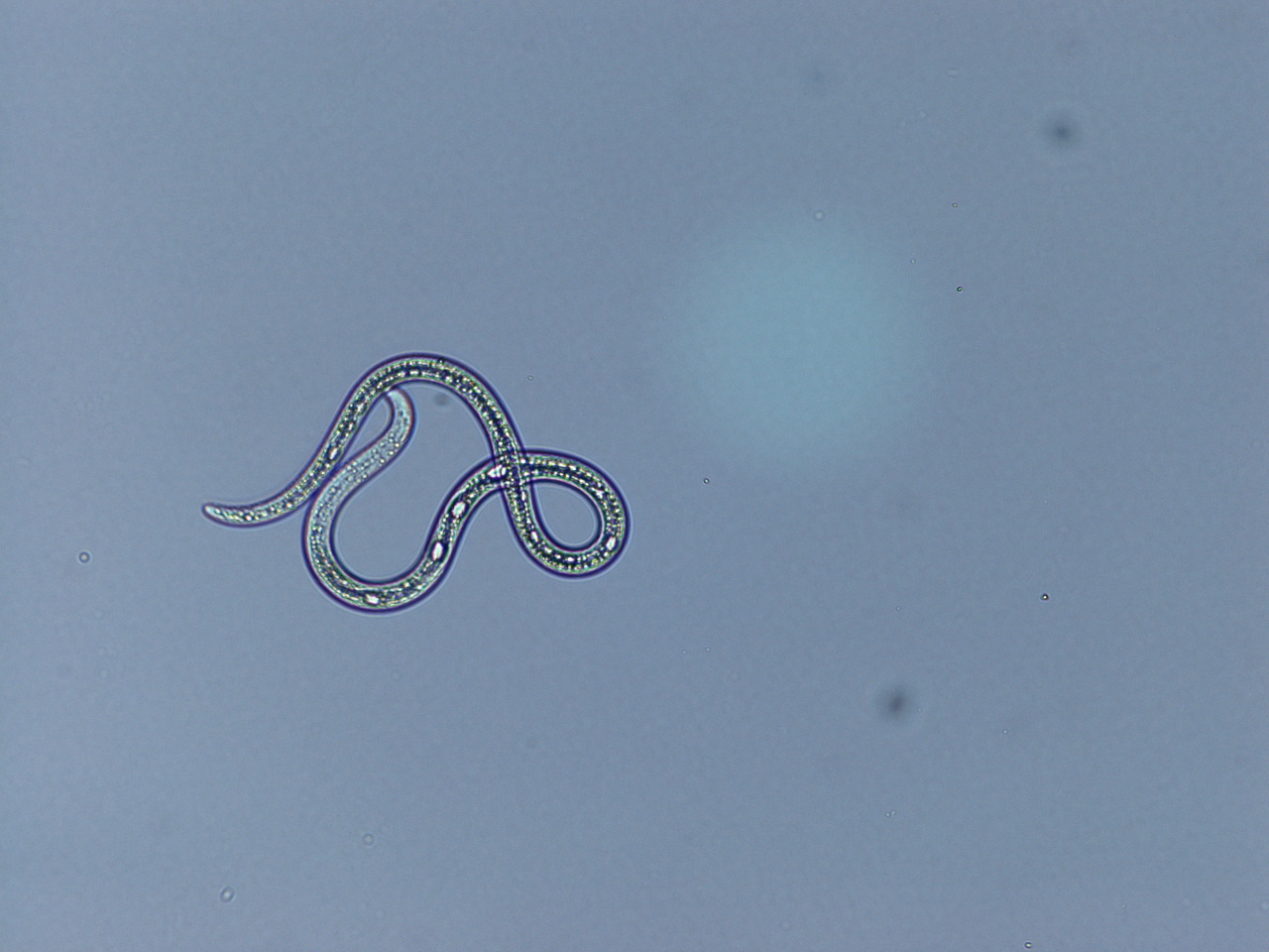 Tallvedsnematoden &auml;r en rundmask som &auml;r mindre &auml;n en millimeter l&aring;ng.